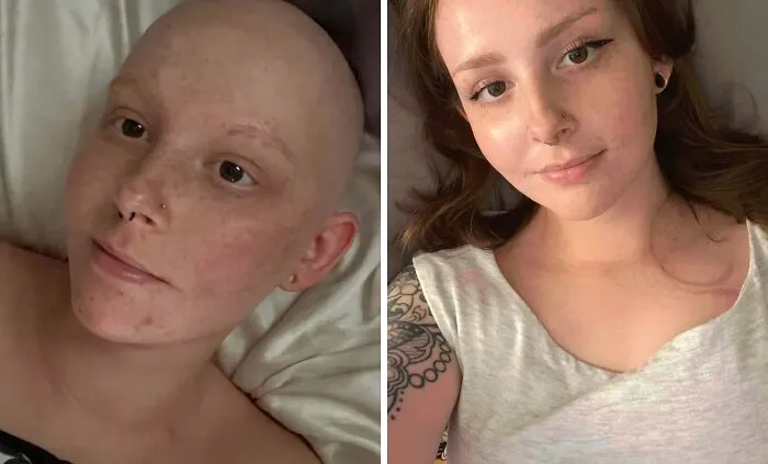 2 Years Later & I’m Cancer Free!