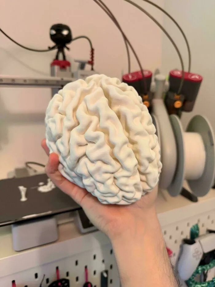 Me hicieron una resonancia magnética e imprimí mi propio cerebro