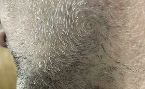 80 Rare Human Features That Make The Body Even More Incredible