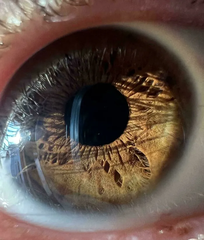 I Have The Shape And Texture Of A Feather At The Bottom Of My Iris