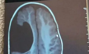 80 Rare Human Features That Make The Body Even More Incredible