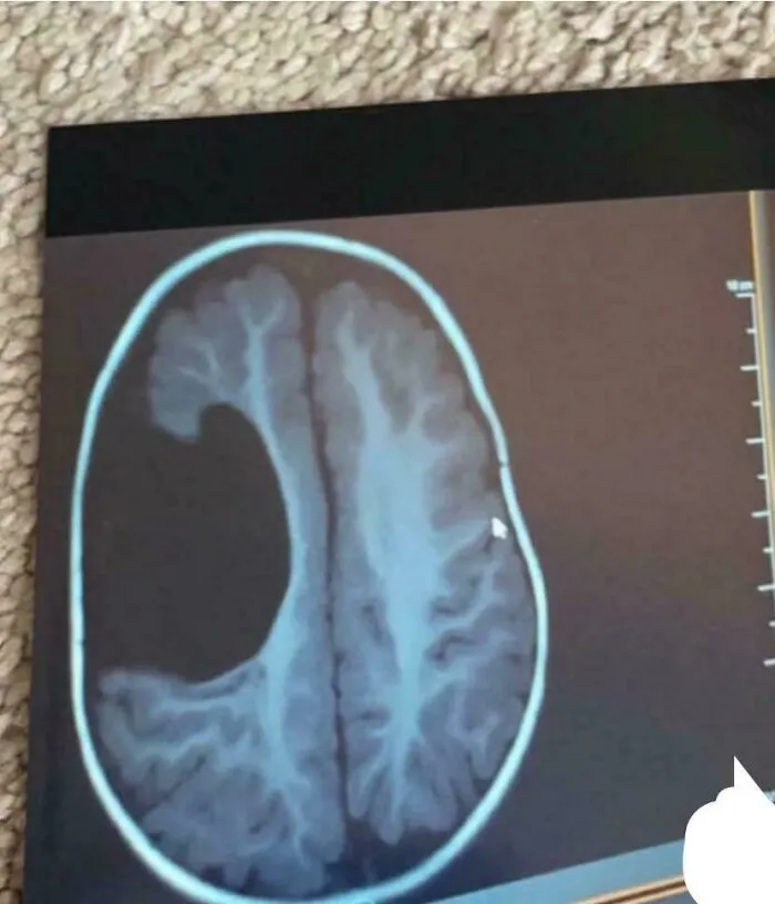MRI Photo Of My Brain Yes This Is Real