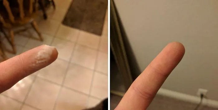 Mi cuerpo me creó una nueva punta del dedo en 30 días.