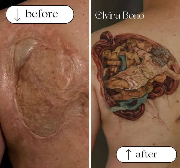 Detail Of Tattoo In Deep Scar On The Back By Accident