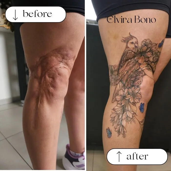 Extensive Scar Tattoo Due To Traffic Accident
