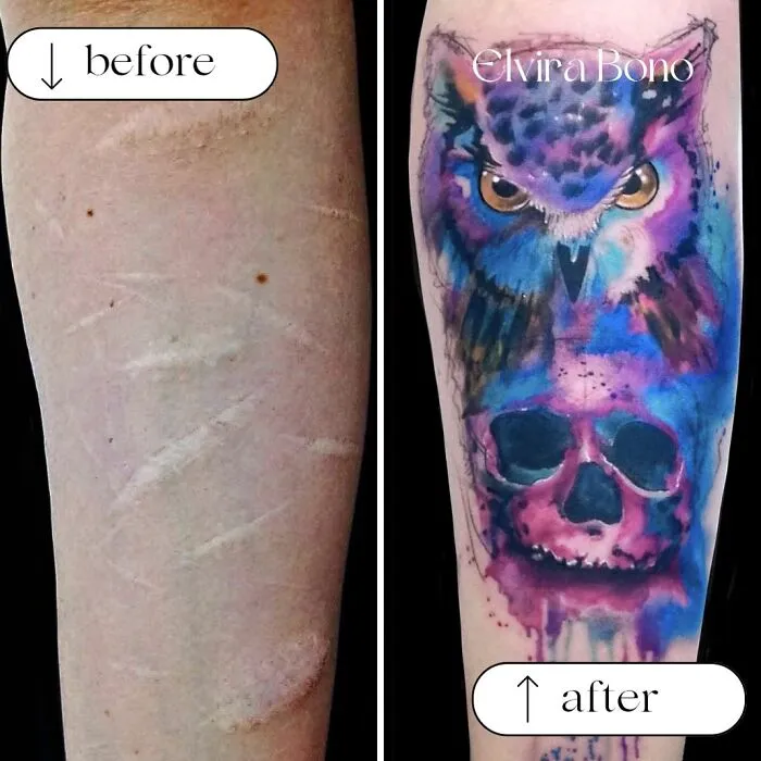 Tattooing On Self-Inflicted Scars