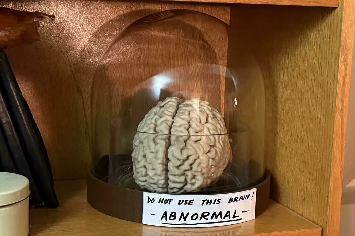 I Got An Mri So I Used The Files To 3D Print My Brain And Put It Under Glass