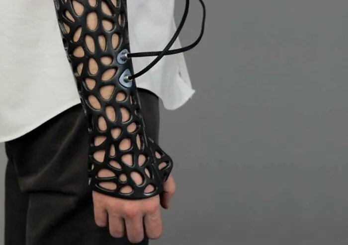 This 3D-Printed Cast Uses Ultrasound To Heal Broken Bones 40% Faster