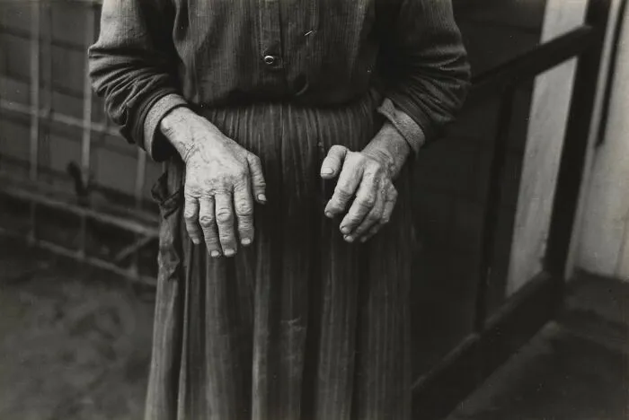 A historical photo focusing on the hands of an elderly person, showing visible signs of aging and possibly arthritis.