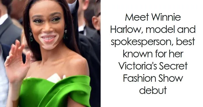 Winnie Harlow: Bio And Career Highlights