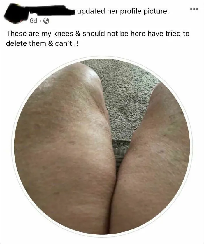 Delete My Knees, Facebook!!