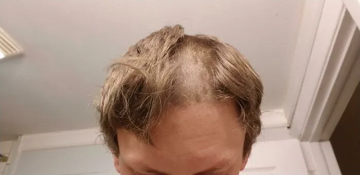 After Fixing My Hair Trimmer, I Forgot To Put The Depth Thing On