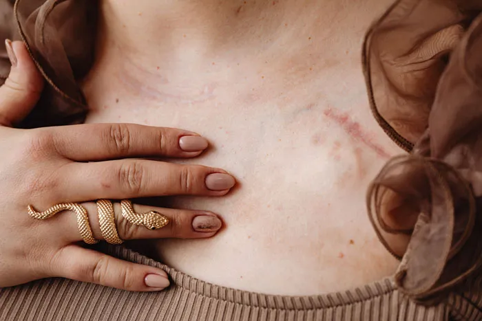 47 Terrifying Real-Life Events That Survivors Will Probably Never Forget