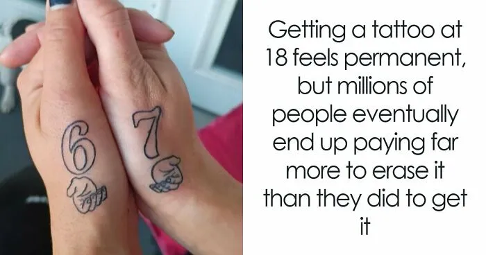 The Tattoos People Swore They'd Love Forever Have Created A Billion-Dollar Industry Of Regret