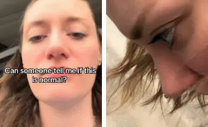 “Please Go To The ER”: Woman’s Bizarre Nose Leak Had Millions Fearing A Potentially Fatal Condition