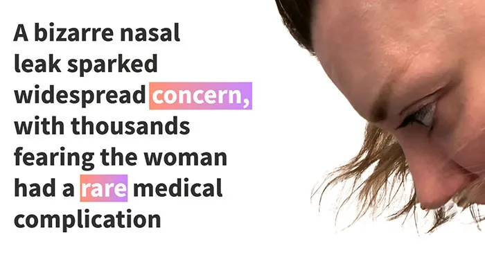 “Please Go To The ER”: Woman’s Bizarre Nose Leak Had Millions Fearing A Potentially Fatal Condition