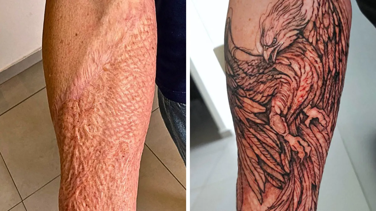 30 Scar Cover-Up Tattoos By Elvira Bono That Help People Feel Comfortable In Their Skin Again