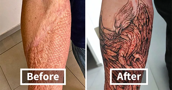 30 Scar Cover-Up Tattoos By Elvira Bono That Help People Feel Comfortable In Their Skin Again
