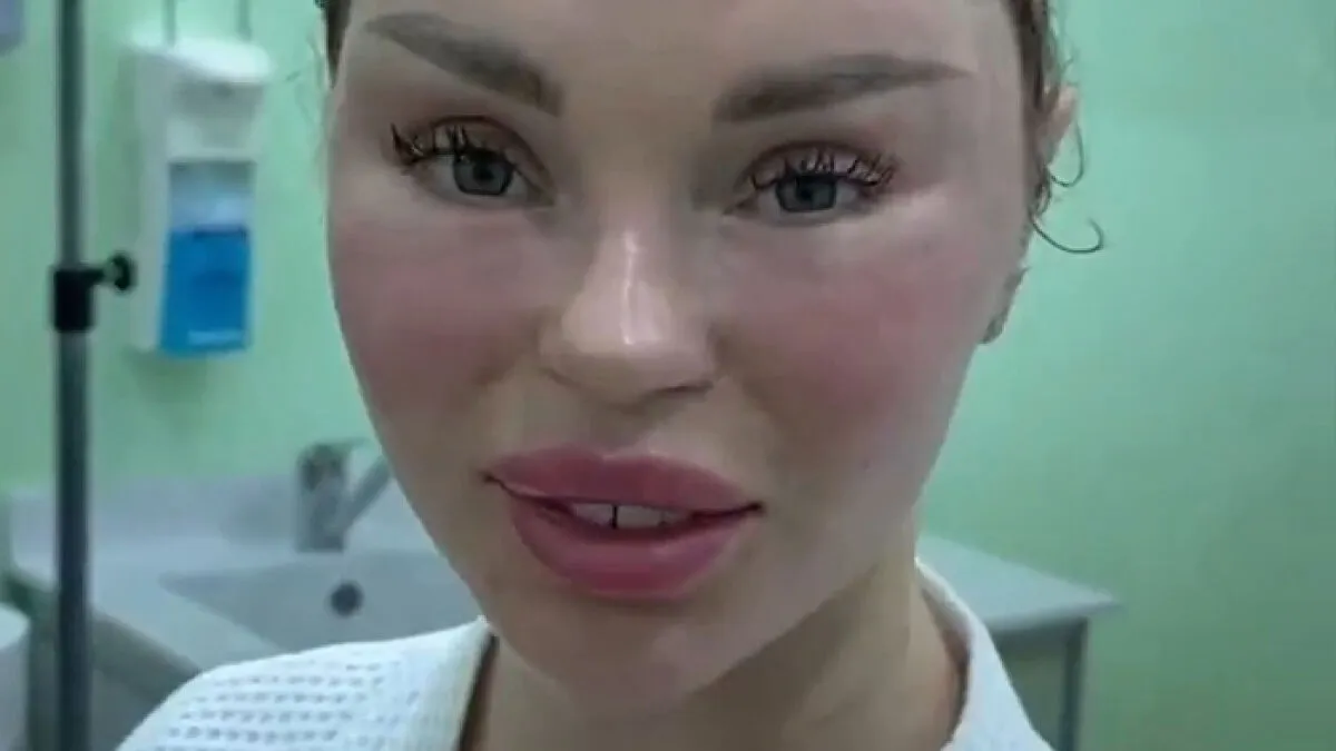 Woman’s Post-Plastic Surgery Photos Divide The Internet As She And Her Surgeon Celebrate The Results
