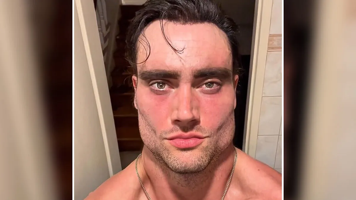 After Lookmaxxer's Bizarre Passing At 32, His Extreme Transformation Stuns Many