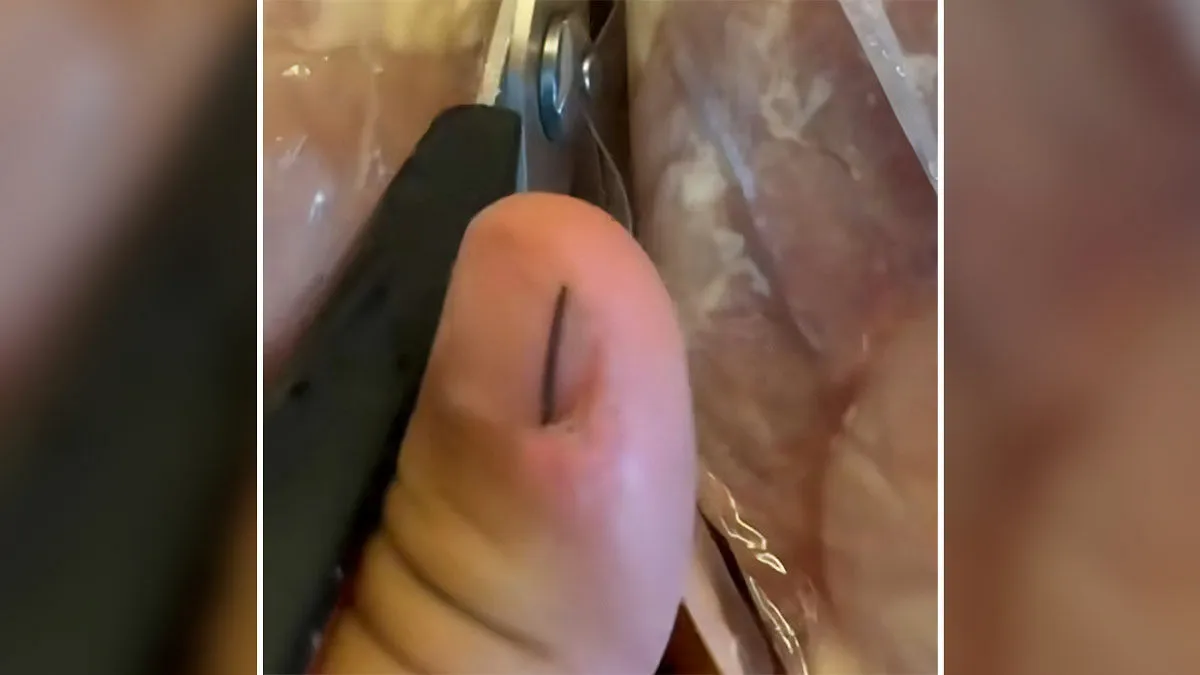 He Just Wanted To Show Off His Costco Chicken, Then Viewers Noticed His Thumb And Pointed Out Something Terrifying