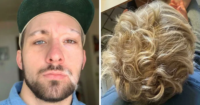 80 Rare Human Features That Make The Body Even More Incredible