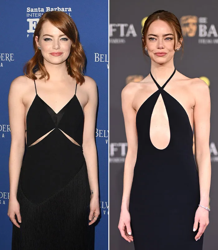 Emma Stone