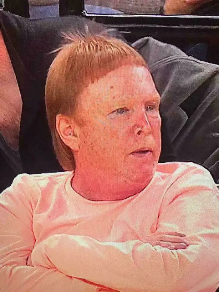 A man with red hair in a short, uneven bowl cut, showcasing a bold hairstyle.