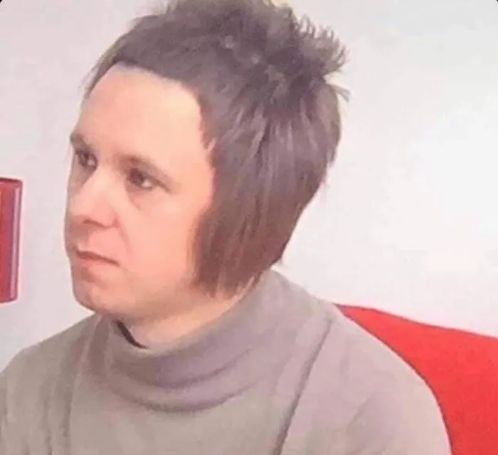 A man with an unusual bowl cut and long sideburns, showcasing bold hairstyles.
