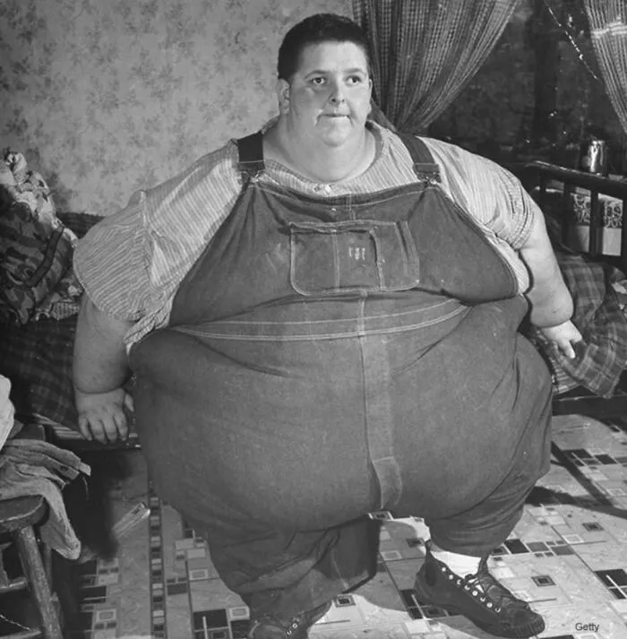The Heaviest Man In History, Jon Browner Minnoch. He Weighed 1,400 Pounds