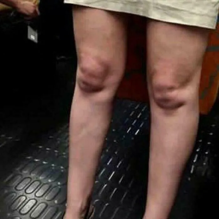 Cursed_knees