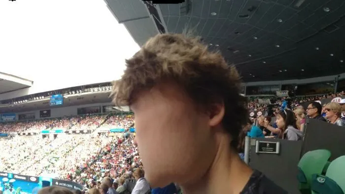 My Friend Took A Panoramic, This Happened To My Face