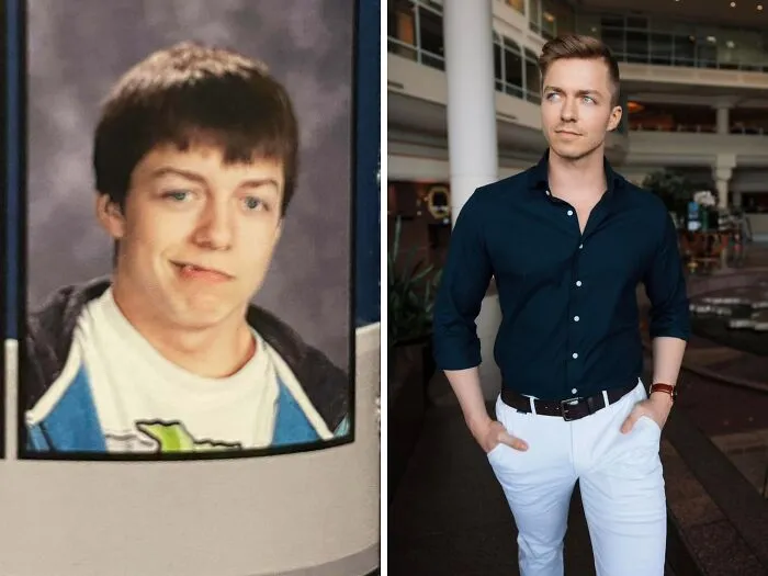 16-26 (BF% + Fixing Facial Asymmetries + Braces)