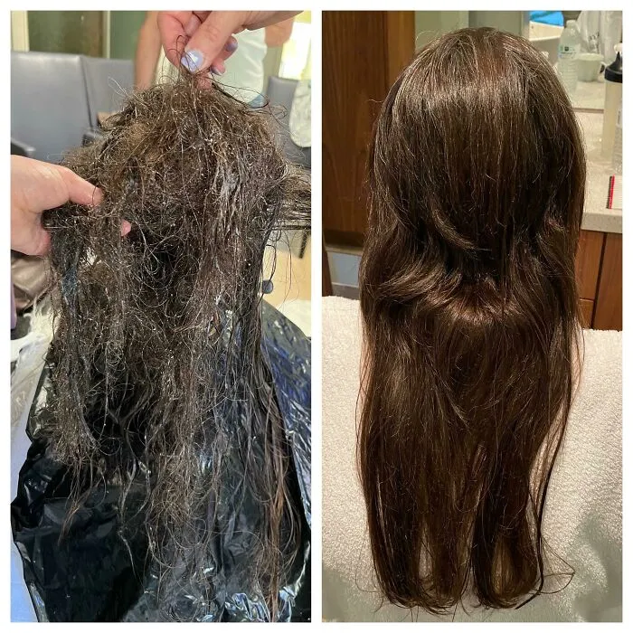 After 4 Hours Of Detangling By 4 People As Well As A Much-Needed Improv Haircut, My Aunt Is Finally Free Of Her Severe Matting After Weeks In The Hospital