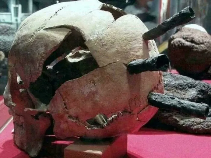 Arrowheads In The Skull Of A Man Who Passed In 1361 During The Battle For The Swedish City Of Visby (Gotland Island)
