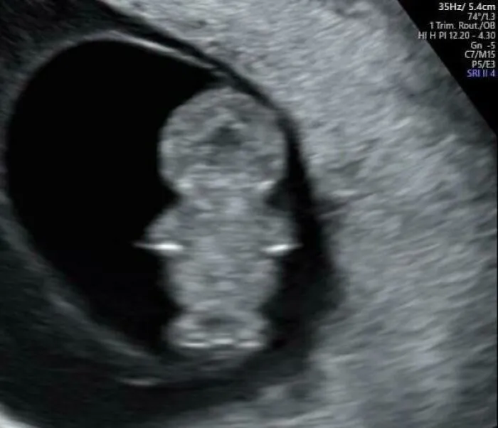My Future Son Looks Like A South Park Character