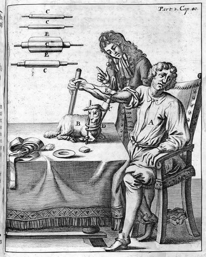 Milk Transfusions (For Tuberculosis)