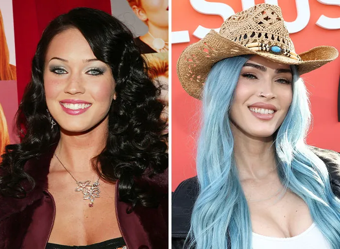 Megan Fox’s Current Look Is The Result Of Multiple Cosmetic Procedures