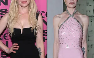 10 Celebrity Women Whose Changing Appearances Have Fans Sounding The Alarm As A Doctor Explains The Serious Risks Behind The Trend