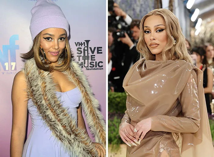 Doja Cat Shaved Her Head And Got Dental Veneers Before Her Rap Return