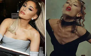 10 Celebrity Women Whose Changing Appearances Have Fans Sounding The Alarm As A Doctor Explains The Serious Risks Behind The Trend
