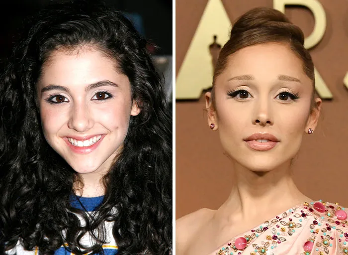 Ariana Grande’s “Skeletal” Appearance Has Worried Her Fans For Some Time 