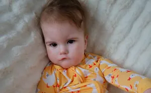 Mom Knew Something Was Wrong When Her Baby Couldn’t Form Expressions, Then Doctors Discovered A Rare Condition