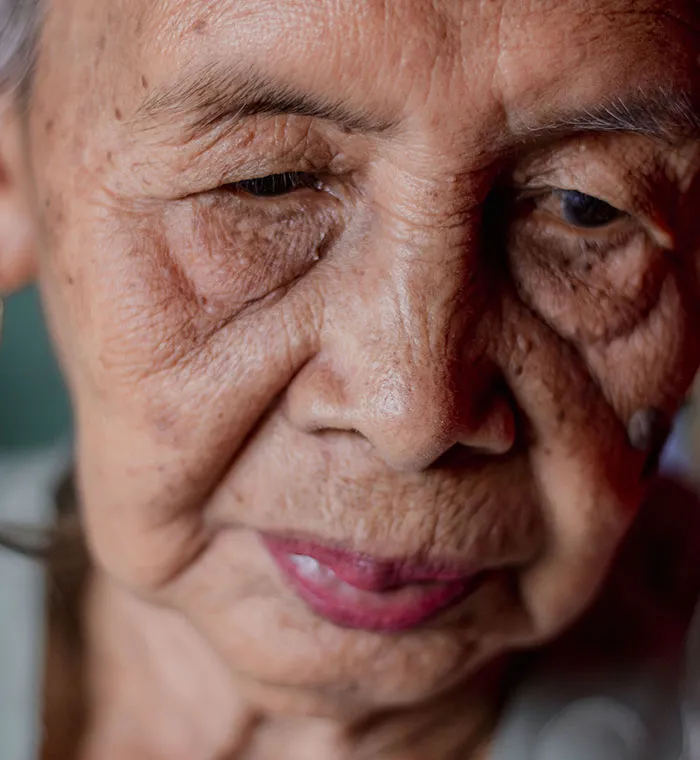 A close-up of an elderly female patient looking down, showing detailed wrinkles. Patients said weird things.
