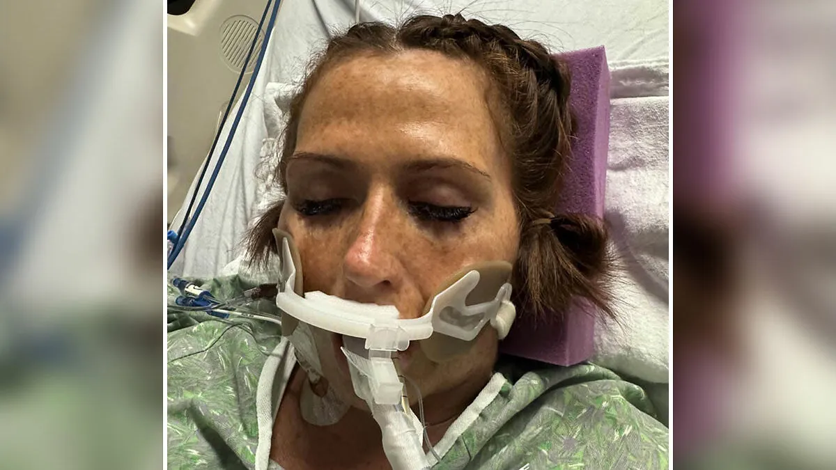 Woman Who Lost ‘A Lot Of My Leg’ To Flesh-Eating Bacteria Warns Women About Common Pre-Swim Habit