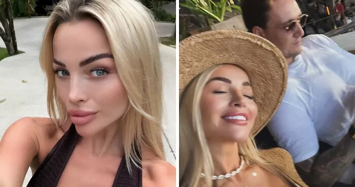 "Man Next To Your Bed": Young Woman Urges Travelers To Be Careful After Nightmare Bali Experience
