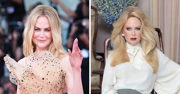 “That Is NOT Nicole Kidman": Plastic Surgeon Weighs In On Why Actress Looks So Different In New Photos