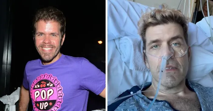 Perez Hilton Faces Permanent “Disfigurement” As New Details Emerge About His Recovery After Disturbing Livestream