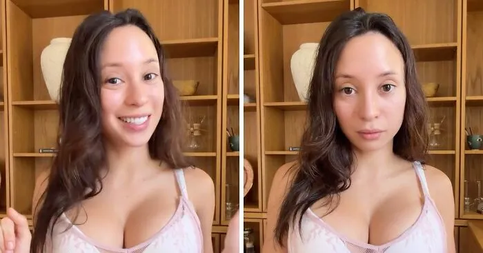 Influencer Reveals The Life-Long Consequences Of Getting Illegal Plastic Surgery: "Biggest Mistake Of My Life"