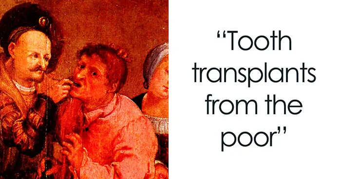 28 Medical Treatments And Devices From The Past That Sound Like They Would Harm You More Than Heal You